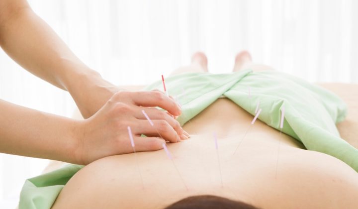 nursing and medical professional article acupuncture