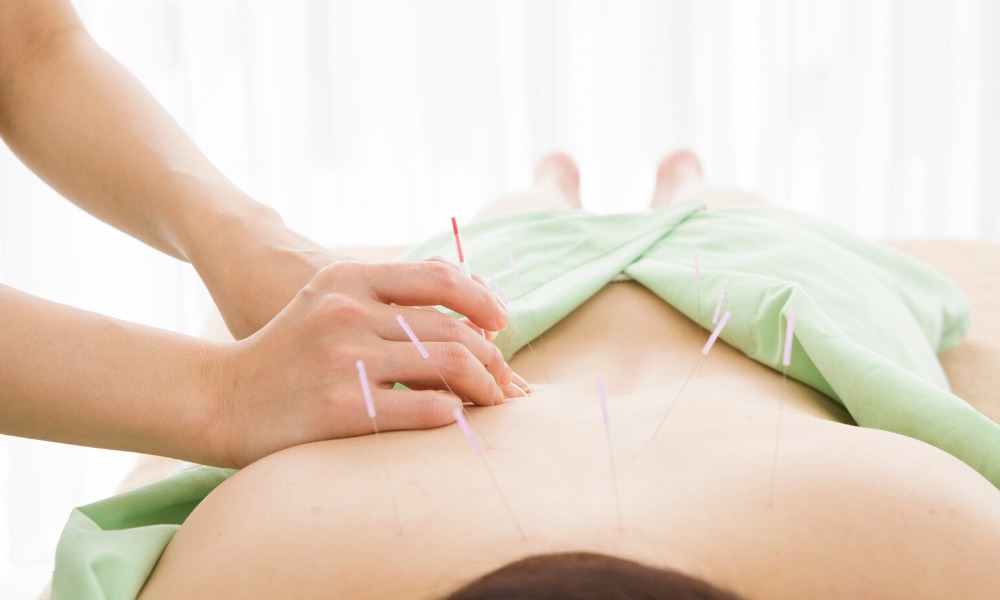 nursing and medical professional article acupuncture